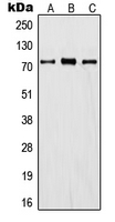 ITIH1 Antibody - Western blot analysis of ITIH1 expression in A549 (A); mouse lung (B); rat kidney (C) whole cell lysates.