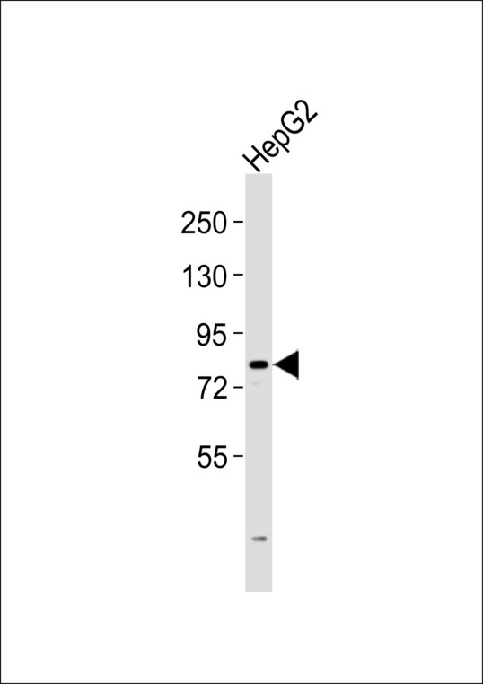 ITIH1 Antibody - Anti-ITIH1 Antibody at 1:1000 dilution + HepG2 whole cell lysates Lysates/proteins at 20 ug per lane. Secondary Goat Anti-Rabbit IgG, (H+L),Peroxidase conjugated at 1/10000 dilution Predicted band size : 101 kDa Blocking/Dilution buffer: 5% NFDM/TBST.