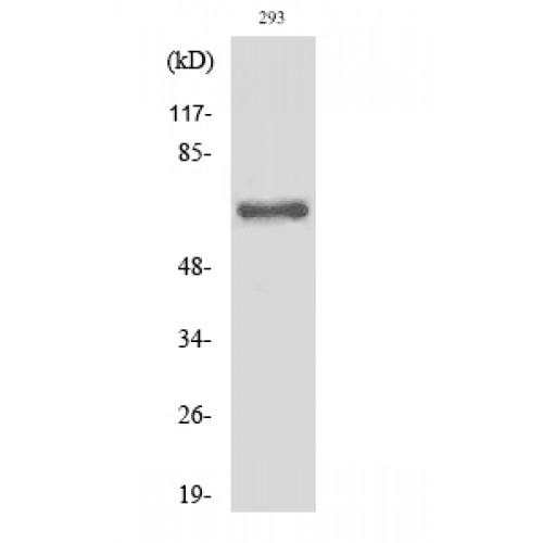 ITIH2 Antibody - Western blot of Cleaved-ITI-H2 (D702) antibody