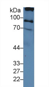 ITIH2 Antibody - Western Blot; Sample: Human Serum; Primary Ab: 3µg/ml Rabbit Anti-Human ITIH2 Antibody Second Ab: 0.2µg/mL HRP-Linked Caprine Anti-Rabbit IgG Polyclonal Antibody