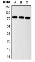 ITIH2 Antibody - Western blot analysis of ITIH2 expression in MCF7 (A); mouse brain (B); rat brain (C) whole cell lysates.