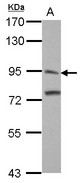 ITIH3 Antibody - Sample (30 ug of whole cell lysate). A: A431. 7.5% SDS PAGE. ITIH3 antibody diluted at 1:1000.