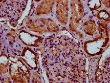 ITIH3 Antibody - Immunohistochemistry Dilution at 1:100 and staining in paraffin-embedded human kidney tissue performed on a Leica BondTM system. After dewaxing and hydration, antigen retrieval was mediated by high pressure in a citrate buffer (pH 6.0). Section was blocked with 10% normal Goat serum 30min at RT. Then primary antibody (1% BSA) was incubated at 4°C overnight. The primary is detected by a biotinylated Secondary antibody and visualized using an HRP conjugated SP system.