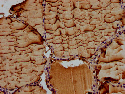 ITIH3 Antibody - Immunohistochemistry Dilution at 1:100 and staining in paraffin-embedded human thyroid tissue performed on a Leica BondTM system. After dewaxing and hydration, antigen retrieval was mediated by high pressure in a citrate buffer (pH 6.0). Section was blocked with 10% normal Goat serum 30min at RT. Then primary antibody (1% BSA) was incubated at 4°C overnight. The primary is detected by a biotinylated Secondary antibody and visualized using an HRP conjugated SP system.