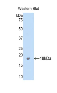 ITIH4 Antibody - Western blot of recombinant ITIH4 / gp120.  This image was taken for the unconjugated form of this product. Other forms have not been tested.