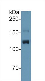 ITIH4 Antibody - Western Blot; Sample: Human Placenta lysate; Primary Ab: 1µg/ml Rabbit Anti-Human ITIH4 Antibody Second Ab: 0.2µg/mL HRP-Linked Caprine Anti-Rabbit IgG Polyclonal Antibody