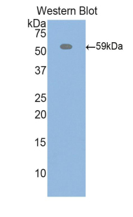 ITIH4 Antibody - Western blot of recombinant ITIH4 / gp120.  This image was taken for the unconjugated form of this product. Other forms have not been tested.