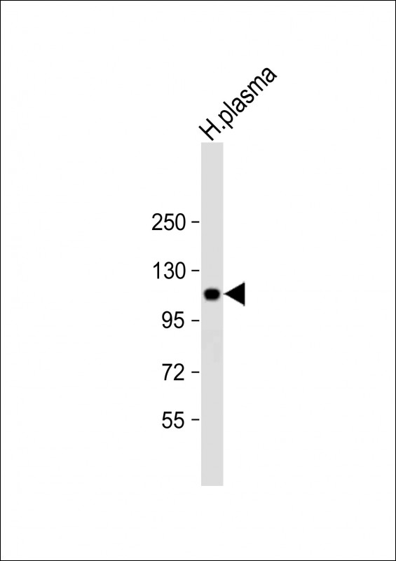 ITIH4 Antibody - Anti-ITIH4 Antibody (C-Term) at 1:2000 dilution + human plasma lysate Lysates/proteins at 20 µg per lane. Secondary Goat Anti-Rabbit IgG, (H+L), Peroxidase conjugated at 1/10000 dilution. Predicted band size: 103 kDa Blocking/Dilution buffer: 5% NFDM/TBST.