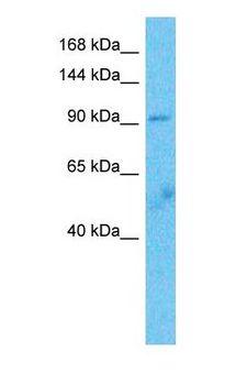 ITIH4 Antibody - Western blot of ITIH4 Antibody with human Fetal Lung lysate.  This image was taken for the unconjugated form of this product. Other forms have not been tested.