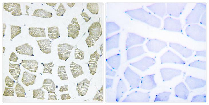 ITIH4 Antibody - Cl-peptide - + Immunohistochemistry analysis of paraffin-embedded human skeletal muscle tissue, using ITIH4 (70k,Cleaved-Arg661) antibody.