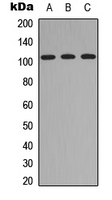 ITIH4 Antibody - Western blot analysis of ITIH4 70k expression in HEK293T (A); Raw264.7 (B); PC12 (C) whole cell lysates.