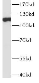ITIH4 Antibody - Mouse lung tissue were subjected to SDS PAGE followed by western blot with ITIH4 antibody at dilution of 1:600