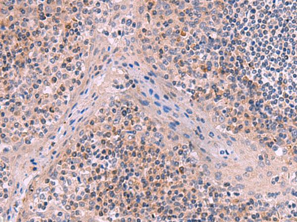 ITIH4 Antibody - Immunohistochemistry of paraffin-embedded Human tonsil tissue  using ITIH4 Polyclonal Antibody at dilution of 1:50(×200)