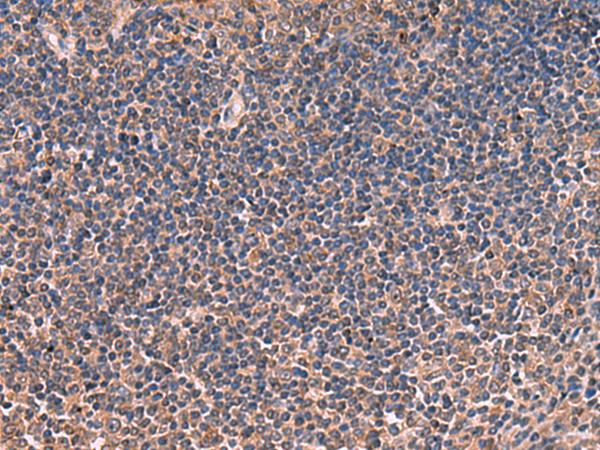 ITIH4 Antibody - Immunohistochemistry of paraffin-embedded Human tonsil tissue  using ITIH4 Polyclonal Antibody at dilution of 1:30(×200)