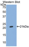 ITIH5 Antibody - Western blot of recombinant ITIH5.  This image was taken for the unconjugated form of this product. Other forms have not been tested.