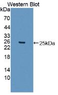 ITIH5 Antibody - Western Blot; Sample: Recombinant protein.