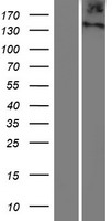 ITIH6 / ITIH5L Protein - Western validation with an anti-DDK antibody * L: Control HEK293 lysate R: Over-expression lysate