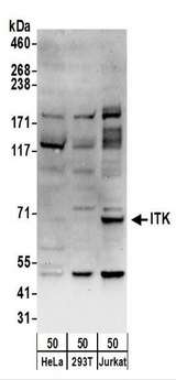 ITK / EMT Antibody - Detection of Human ITK by Western Blot. Samples: Whole cell lysate (50 ug) from HeLa (RIPA), 293T (RIPA), and Jurkat (RIPA) cells. Antibodies: Affinity purified rabbit anti-ITK antibody used for WB at 1 ug/ml. Detection: Chemiluminescence with an exposure time of 30 seconds.