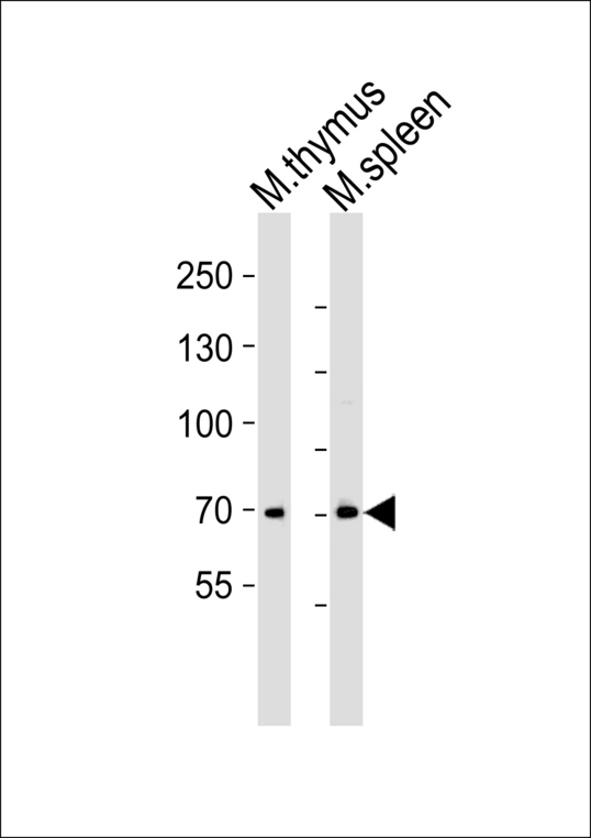 ITK / EMT Antibody - Western blot of lysates from mouse thymus and mouse spleen tissue lysate (from left to right) with Mouse Itk Antibody. Antibody was diluted at 1:1000 at each lane. A goat anti-rabbit IgG H&L (HRP) at 1:5000 dilution was used as the secondary antibody. Lysates at 35 ug per lane.
