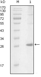 ITK / EMT Antibody - Western blot using ITK mouse monoclonal antibody against truncated Trx-ITK recombinant protein (1).
