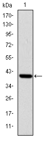 ITK / EMT Antibody - Western blot using ITK monoclonal antibody against human ITK (AA: 2-120) recombinant protein. (Expected MW is 39.7 kDa)