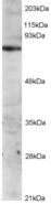 ITK / EMT Antibody - Antibody staining (2 ug/ml) of Jurkat lysate (RIPA buffer, 1.4E+05 cells per lane). Primary incubated for 12 hour. Detected by Western blot of chemiluminescence.