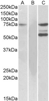 ITK / EMT Antibody - HEK293 lysate (10ug protein in RIPA buffer) overexpressing Human (ITK) with DYKDDDDK tag probed with Goat Anti-ITK Antibody (1ug/ml) in Lane A and probed with anti-DYKDDDDK Tag (1/10000) in lane C. Mock-transfected HEK293 probed with Goat Anti-ASNSD1 Antibody (1mg/ml) in Lane B. Primary incubations were for 1 hour. Detected by chemiluminescencence.