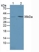 ITLN1 / Omentin Antibody - Western Blot; Sample. Lane1: Mouse Intestine Tissue; Lane2: Mouse Stomach Tissue.