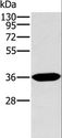 ITLN1 / Omentin Antibody - Western blot analysis of Human fetal intestine tissue, using ITLN1 Polyclonal Antibody at dilution of 1:400.