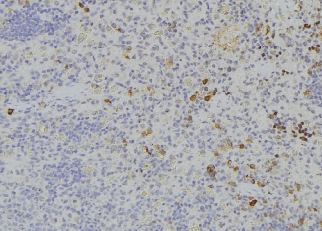 ITLN1 / Omentin Antibody - 1:100 staining human lymph node tissue by IHC-P. The sample was formaldehyde fixed and a heat mediated antigen retrieval step in citrate buffer was performed. The sample was then blocked and incubated with the antibody for 1.5 hours at 22°C. An HRP conjugated goat anti-rabbit antibody was used as the secondary.
