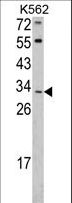 ITM2A Antibody - Western blot of ITM2A Antibody in K562 cell line lysates (35 ug/lane). ITM2A (arrow) was detected using the purified antibody.
