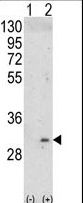 ITM2A Antibody - Western blot of ITM2A (arrow) using rabbit polyclonal ITM2A Antibody. 293 cell lysates (2 ug/lane) either nontransfected (Lane 1) or transiently transfected with the ITM2A gene (Lane 2).