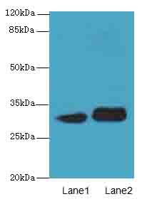 ITM2A Antibody - Western blot. All lanes: ITM2A antibody at 0.3 ug/ml. Lane 1: HL60 whole cell lysate. Lane 2: SH-SY5Y whole cell lysate. Secondary Goat polyclonal to Rabbit IgG at 1:10000 dilution. Predicted band size: 30 kDa. Observed band size: 30 kDa.