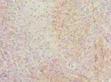 ITM2A Antibody - Immunohistochemistry of paraffin-embedded human tonsil tissue using antibody at dilution of 1:100.