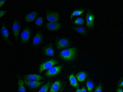ITM2A Antibody - Immunofluorescent analysis of A549 cells using ITM2A Antibody at dilution of 1:100 and Alexa Fluor 488-congugated AffiniPure Goat Anti-Rabbit IgG(H+L)