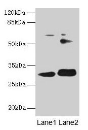ITM2A Antibody - Western blot All lanes: ITM2A antibody at 0.3µg/ml Lane 1: HL60 whole cell lysate Lane 2: SH-SY5Y whole cell lysate Secondary Goat polyclonal to rabbit IgG at 1/10000 dilution Predicted band size: 30, 25 kDa Observed band size: 30 kDa