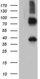 ITM2A Antibody - HEK293T cells were transfected with the pCMV6-ENTRY control. (Left lane) or pCMV6-ENTRY ITM2A. (Right lane) cDNA for 48 hrs and lysed