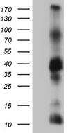 ITM2A Antibody - HEK293T cells were transfected with the pCMV6-ENTRY control. (Left lane) or pCMV6-ENTRY ITM2A. (Right lane) cDNA for 48 hrs and lysed