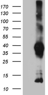 ITM2A Antibody - HEK293T cells were transfected with the pCMV6-ENTRY control. (Left lane) or pCMV6-ENTRY ITM2A. (Right lane) cDNA for 48 hrs and lysed