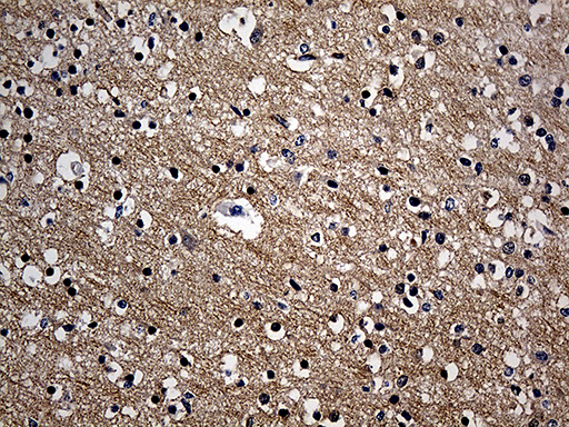 ITM2A Antibody - Immunohistochemical staining of paraffin-embedded Human adult brain tissue within the normal limits using anti-ITM2A mouse monoclonal antibody. (Heat-induced epitope retrieval by 1mM EDTA in 10mM Tris buffer. (pH8.5) at 120 oC for 3 min. (1:250)