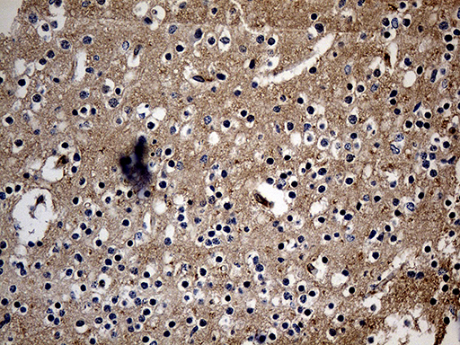 ITM2A Antibody - Immunohistochemical staining of paraffin-embedded Human embryonic cerebellum within the normal limits using anti-ITM2A mouse monoclonal antibody. (Heat-induced epitope retrieval by 1mM EDTA in 10mM Tris buffer. (pH8.5) at 120 oC for 3 min. (1:250)