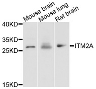 ITM2A Antibody - Western blot analysis of extracts of various cell lines, using ITM2A antibody at 1:1000 dilution. The secondary antibody used was an HRP Goat Anti-Rabbit IgG (H+L) at 1:10000 dilution. Lysates were loaded 25ug per lane and 3% nonfat dry milk in TBST was used for blocking. An ECL Kit was used for detection and the exposure time was 30s.