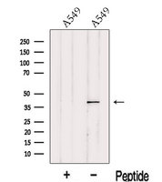 ITM2A Antibody - Western blot analysis of extracts of A549 cells using ITM2A antibody. The lane on the left was treated with blocking peptide.