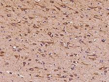 ITM2A Antibody - Immunochemical staining of human ITM2A in human brain with rabbit polyclonal antibody at 1:1000 dilution, formalin-fixed paraffin embedded sections.