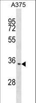 ITM2C Antibody - ITM2C Antibody western blot of A375 cell line lysates (35 ug/lane). The ITM2C antibody detected the ITM2C protein (arrow).