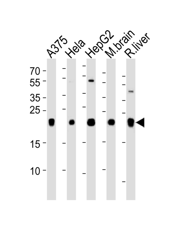 ITPA Antibody - Western blot of lysates from A375, HeLa, HepG2 cell line, mouse brain and rat liver tissue lysate(from left to right), using ITPA Antibody. Antibody was diluted at 1:1000 at each lane. A goat anti-rabbit IgG H&L (HRP) at 1:5000 dilution was used as the secondary antibody. Lysates at 35ug per lane.