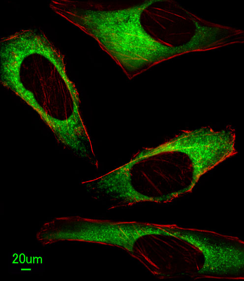 ITPA Antibody - Immunofluorescence of HeLa cells, using ITPA Antibody. Antibody was diluted at 1:25 dilution. Alexa Fluor 488-conjugated goat anti-rabbit lgG at 1:400 dilution was used as the secondary antibody (green). Cytoplasmic actin was counterstained with Dylight Fluor 554 (red) conjugated Phalloidin (red).