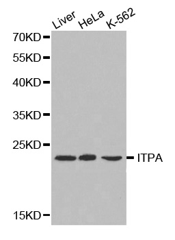 ITPA Antibody - Western blot analysis of extracts of various cell lines, using ITPA antibody.