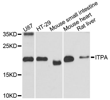 ITPA Antibody - Western blot analysis of extracts of various cell lines, using ITPA antibody at 1:3000 dilution. The secondary antibody used was an HRP Goat Anti-Rabbit IgG (H+L) at 1:10000 dilution. Lysates were loaded 25ug per lane and 3% nonfat dry milk in TBST was used for blocking. An ECL Kit was used for detection and the exposure time was 90s.