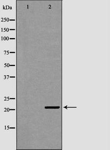 ITPA Antibody - Western blot analysis of HepG2 whole cells lysates using ITPA antibody. The lane on the left is treated with the antigen-specific peptide.